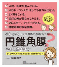 それって円錐角膜かもしれません - １０代、２０代のうちに気づいて欲しい