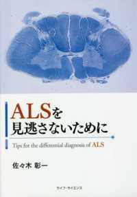 ＡＬＳを見逃さないために