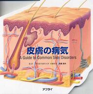 皮膚の病気