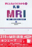 手にとるようにわかる乳腺ＭＲＩ - 撮像・読影の基本と臨床例