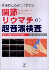 手にとるようにわかる関節リウマチの超音波検査 - 基礎・走査方法から症例まで