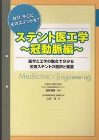 ステント医工学 〈冠動脈編〉 - なぜそこにそのステントを？