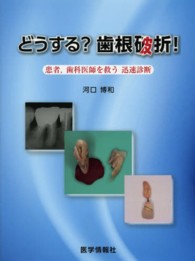 どうする？歯根破折！ - 患者，歯科医師を救う迅速診断
