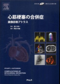 心筋梗塞の合併症 - 画像診断アトラス