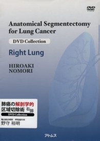 肺癌の解剖学的区域切除術右肺 ＤＶＤ　ｃｏｌｌｅｃｔｉｏｎ