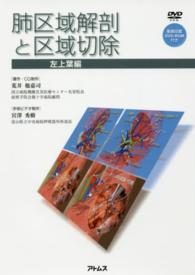 肺区域解剖と区域切除 〈左上葉編〉