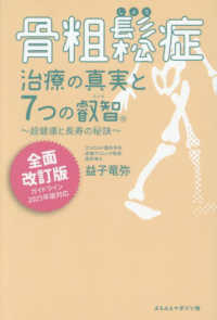 骨粗鬆症治療の真実と７つの叡智