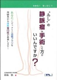 “あし”の静脈瘤は手術した方がいいんですか？ わかる！なっとく！！