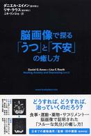 脳画像で探る「うつ」と「不安」の癒し方