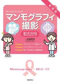 手にとるようにわかるマンモグラフィ撮影 - 見てすぐわかるポジショニング