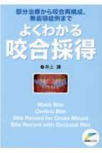 よくわかる咬合採得 - 部分治療から咬合再構成、無歯顎症例まで
