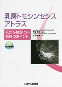 乳房トモシンセシスアトラス　乳がん検診での読影のポイント - Ｗｅｂ動画付