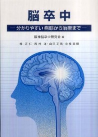 脳卒中 - 分かりやすい病態から治療まで