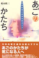 あごのかたち - 外科的矯正歯科治療ガイド