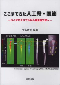 ここまできた人工骨・関節 - バイオマテリアルから再生医工学へ