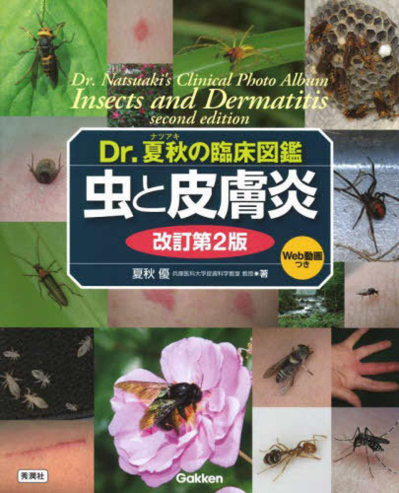 虫と皮膚炎　優【著】　夏秋　紀伊國屋書店ウェブストア｜オンライン書店｜本、雑誌の通販、電子書籍ストア