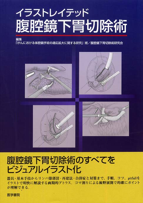 令和スタイル 鏡視下 胃手術のすべて | 比企 直樹, 布部 創也