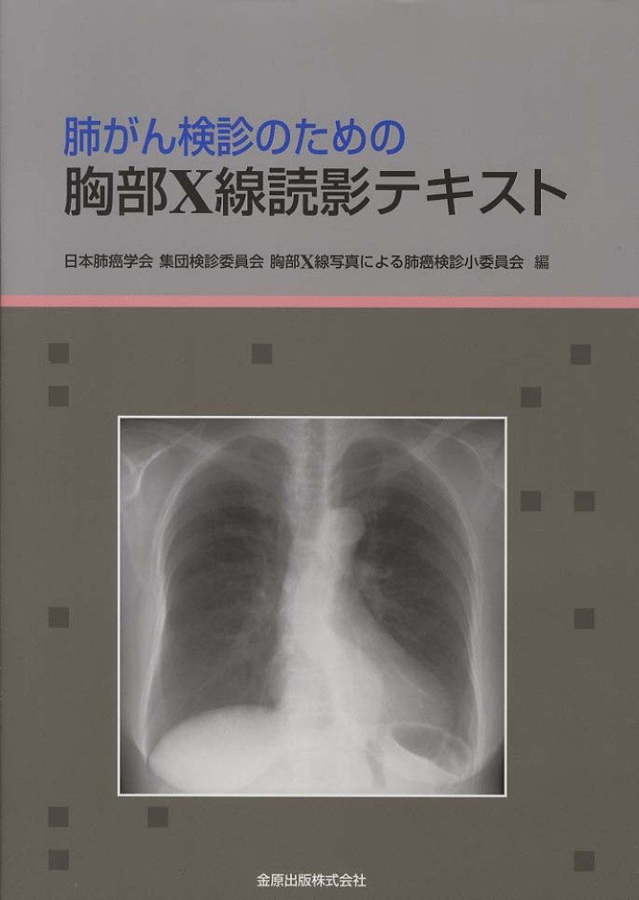 肺がん検診のための胸部X線読影テキスト | 日本肺癌学会集団検診
