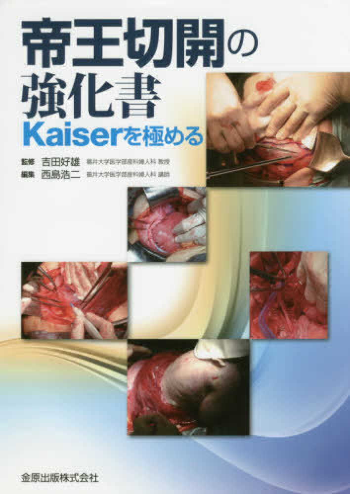 Amazon.com: 帝王切開の強化書 Kaiserを極める: 9784307301343