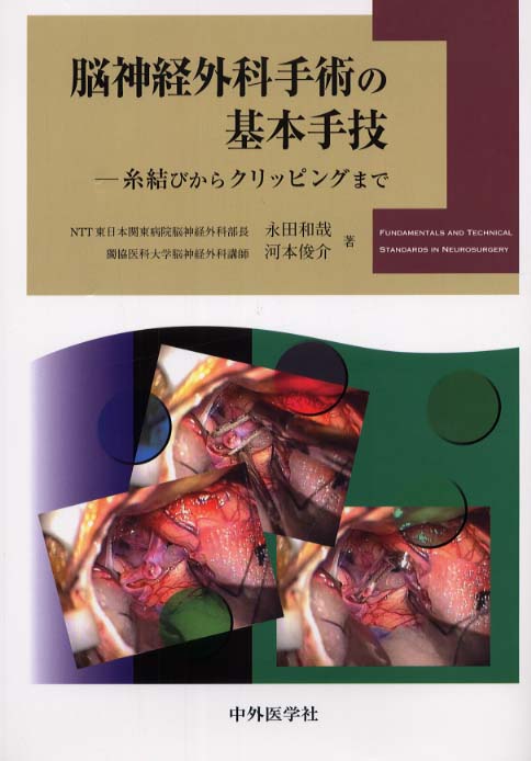 脳神経外科手術の基本手技 / 永田和哉/河本俊介 - 紀伊國屋書店ウェブ ...