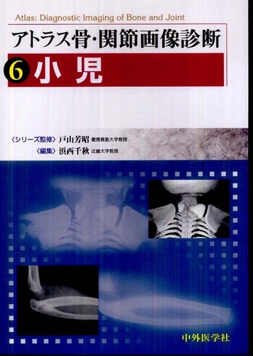 アトラス骨・関節画像診断 6 |本 | 通販 | Amazon
