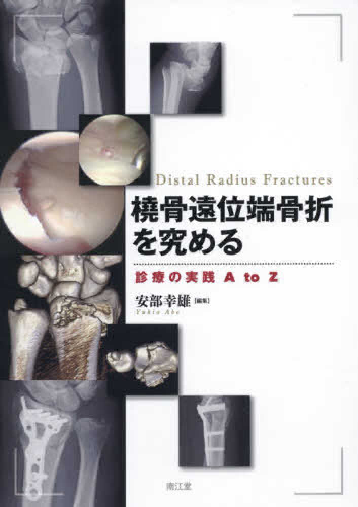 Amazon.co.jp: 橈骨遠位端骨折を究める: 診療の実践 A to Z