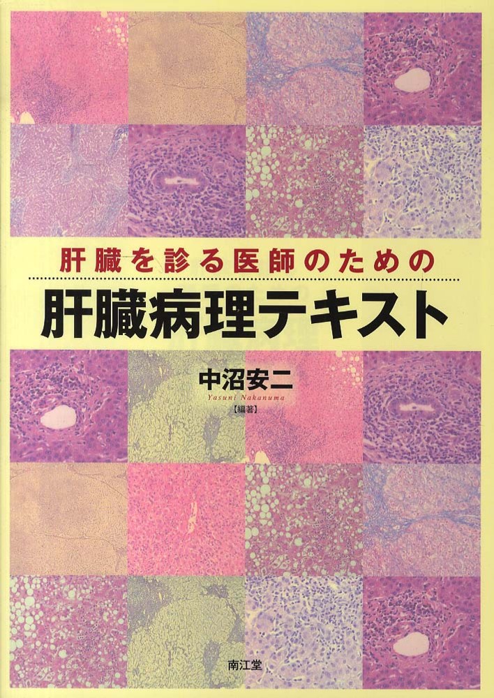 肝臓を診る医師のための肝臓病理テキスト　中沼　安二【編著】　紀伊國屋書店ウェブストア｜オンライン書店｜本、雑誌の通販、電子書籍ストア