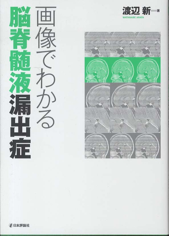 Amazon.co.jp: 画像でわかる脳脊髄液漏出症 : 渡辺 新, 木内