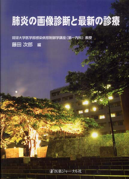 肺炎の画像診断と最新の診療 健診時、胸部に異常がみられた方へ｜健康サポートについて｜医療