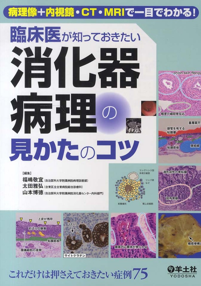 臨床医が知っておきたい消化器病理の見かたのコツ / 福嶋 敬宜/太田 雅弘/山本 博徳【編】 - 紀伊國屋書店ウェブストア｜オンライン書店｜本