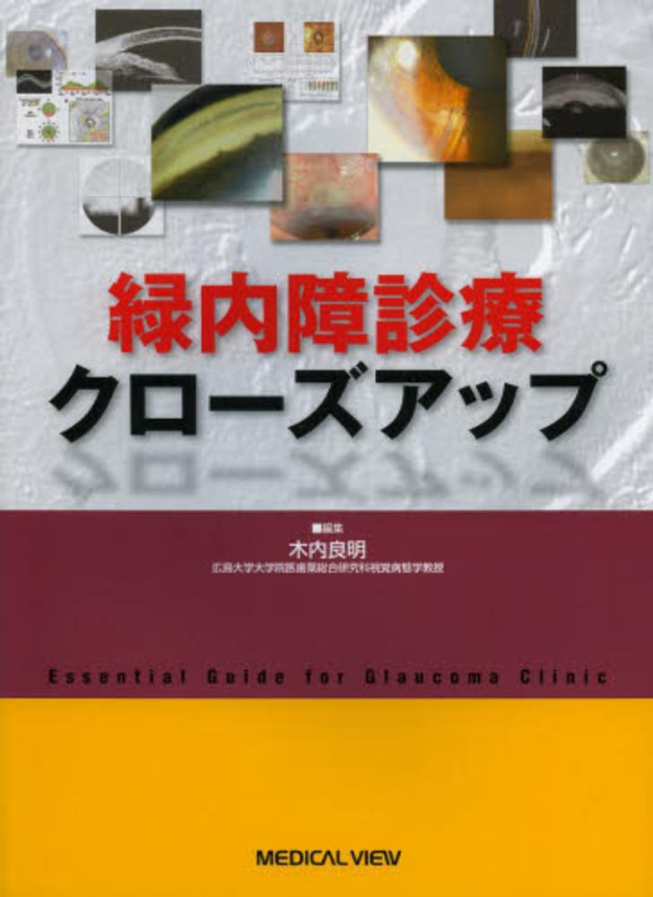 緑内障診療クローズアップ