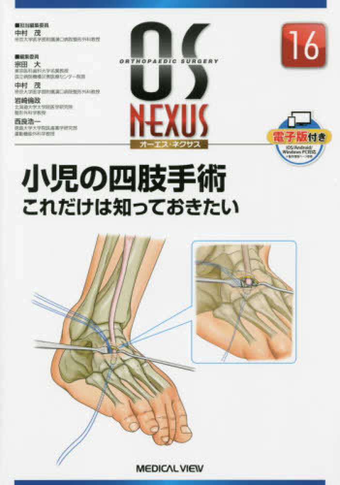 小児の四肢手術 これだけは知っておきたい (OS NEXUS(電子版付き