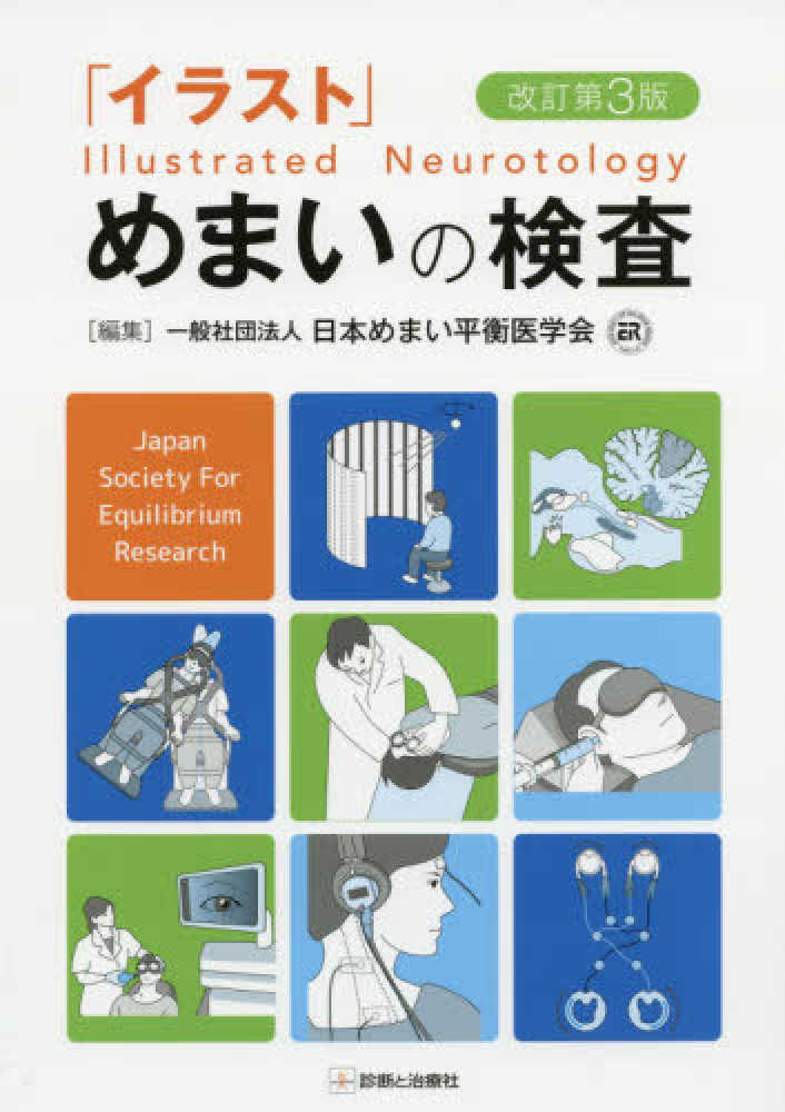 イラスト」めまいの検査 / 日本めまい平衡医学会【編