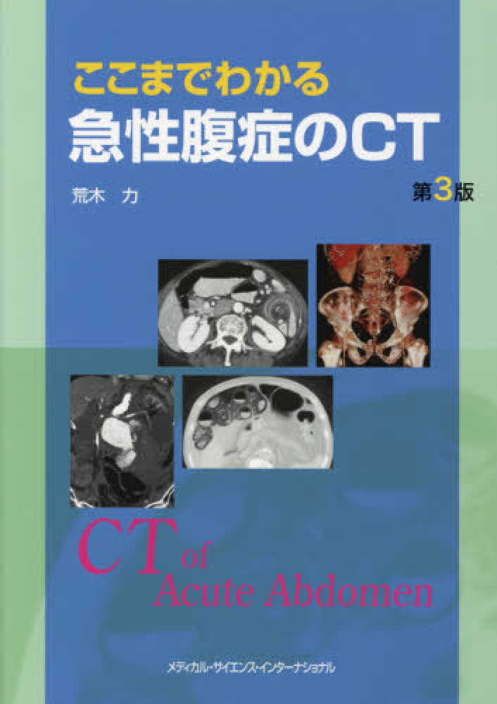 最大12%OFFクーポン / ここまでわかる急性腹症のCT 荒木 紀伊國屋書店 - 力【著】 医学一般