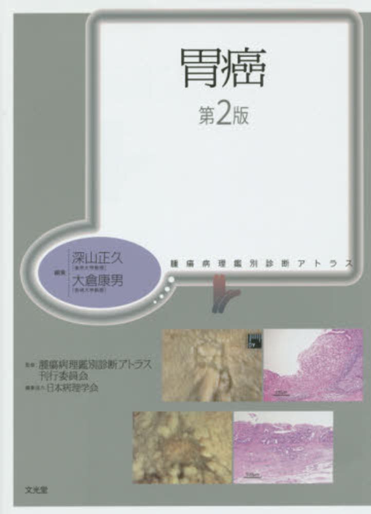 福袋 バースデイ 胃癌 康男【編】/腫瘍病理鑑別診断アトラス 正久/大倉 深山 / 健康+医学