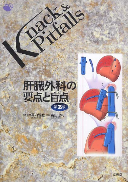 肝臓外科の要点と盲点 / 幕内 雅敏【監修】/高山 忠利【編