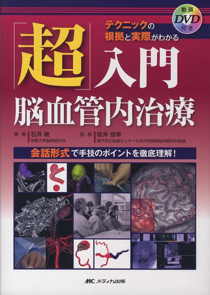 超」入門脳血管内治療 / 石井暁/坂井信幸 - 紀伊國屋書店ウェブ