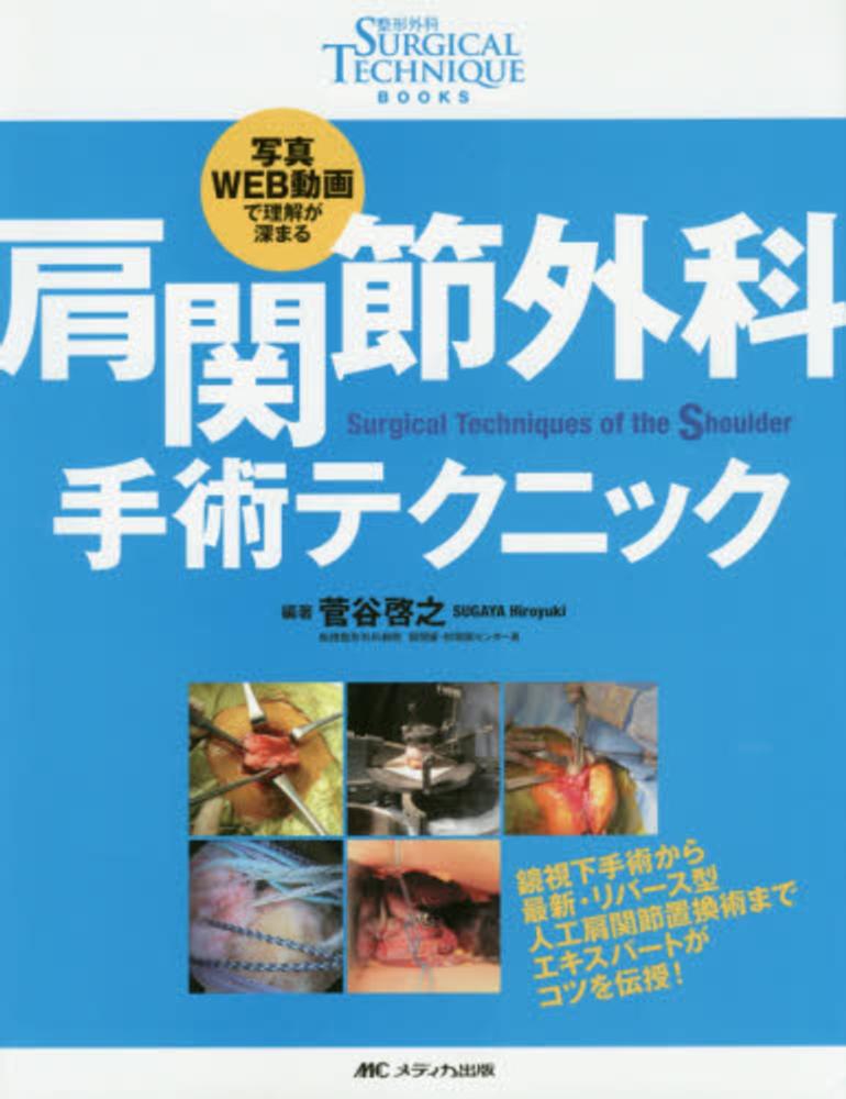 肩関節外科 手術テクニック: 写真・WEB動画で理解が深まる 肩関節外科 手術テクニック: 写真・WEB動画で理解が深まる