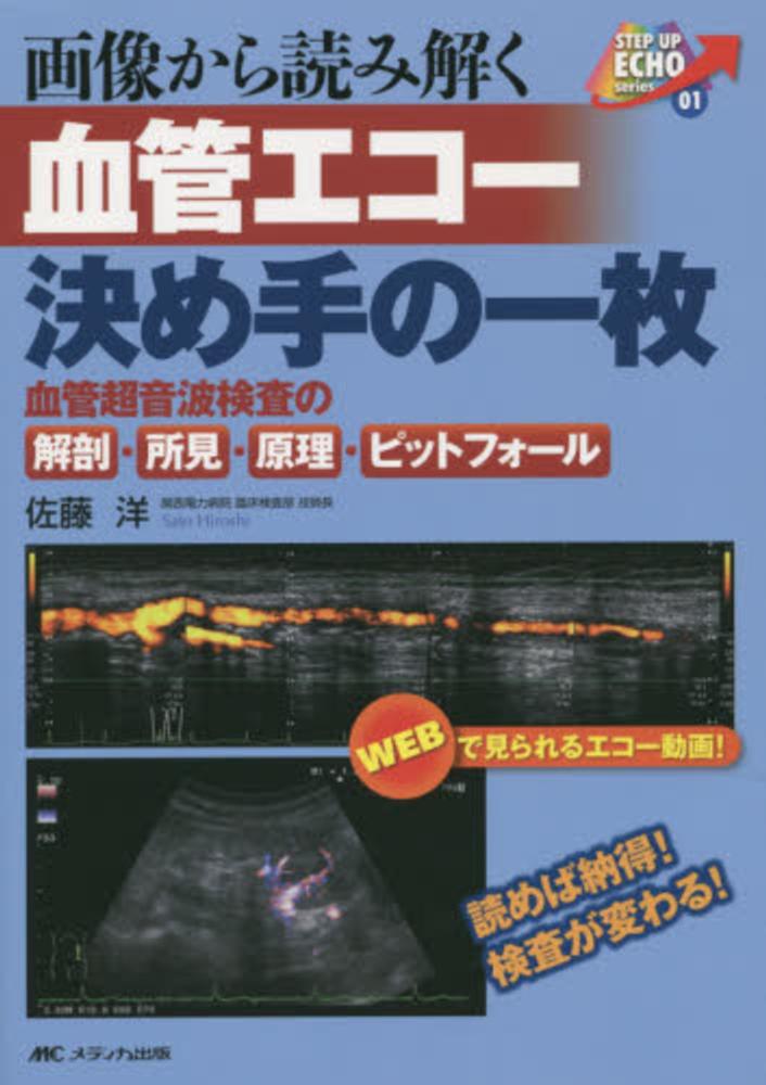 画像から読み解く血管エコー決め手の一枚 血管超音波検査の解剖