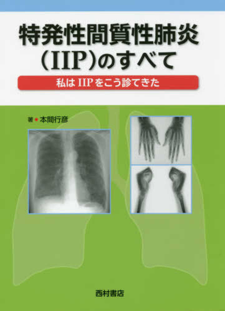 福袋 セール 特発性間質性肺炎（IIP）のすべて / 本間 行彦【著 健康+医学