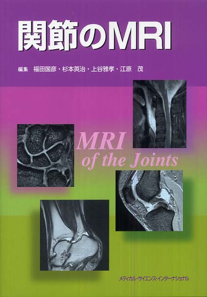 関節のMRI 第2版 福田国彦? 上谷雅孝? 杉本英治; 江原 茂 関節のMRI / 福田 国彦/杉本 英治/上谷 雅孝/江原 茂【編