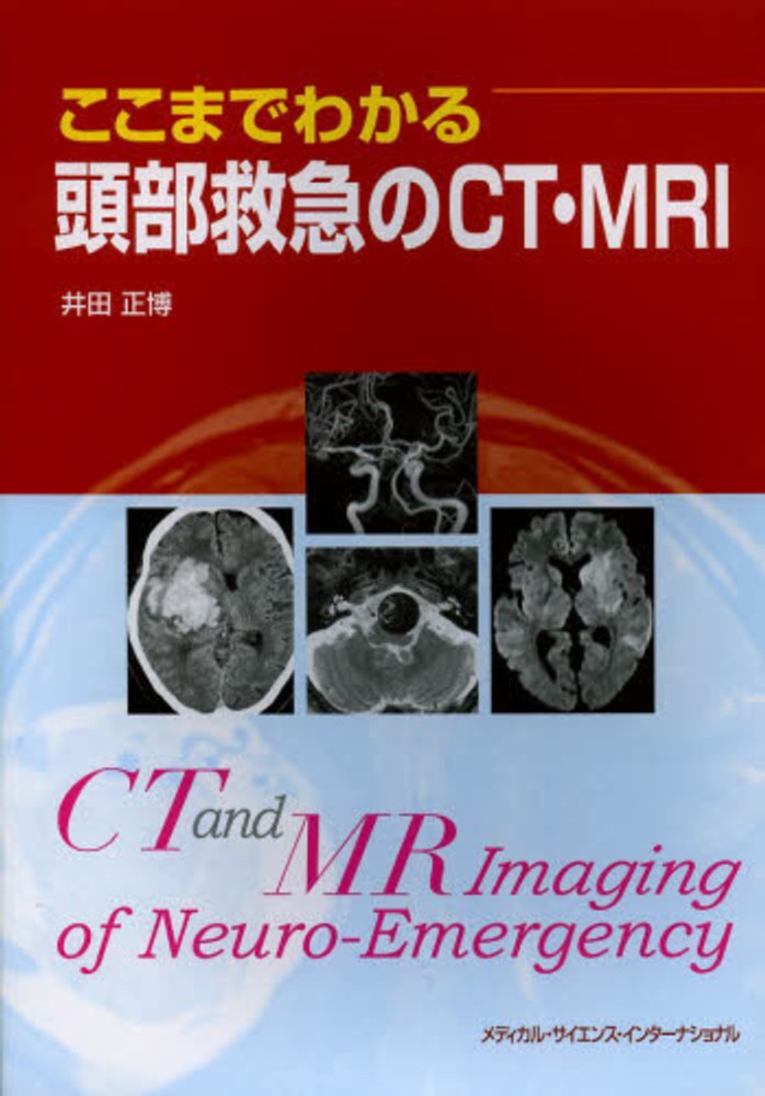 ここまでわかる頭部救急のCT・MRI / 井田 正博【著