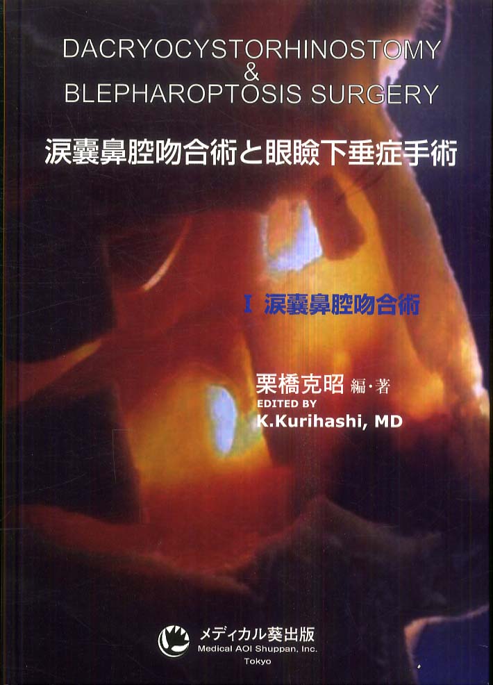 涙嚢鼻腔吻合術と眼瞼下垂症手術　１　栗橋克昭　紀伊國屋書店ウェブストア｜オンライン書店｜本、雑誌の通販、電子書籍ストア