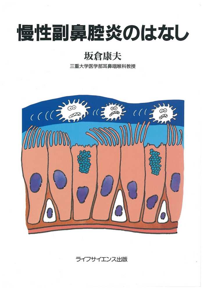 慢性副鼻腔炎のはなし | 坂倉 康夫 |本 | 通販 | Amazon