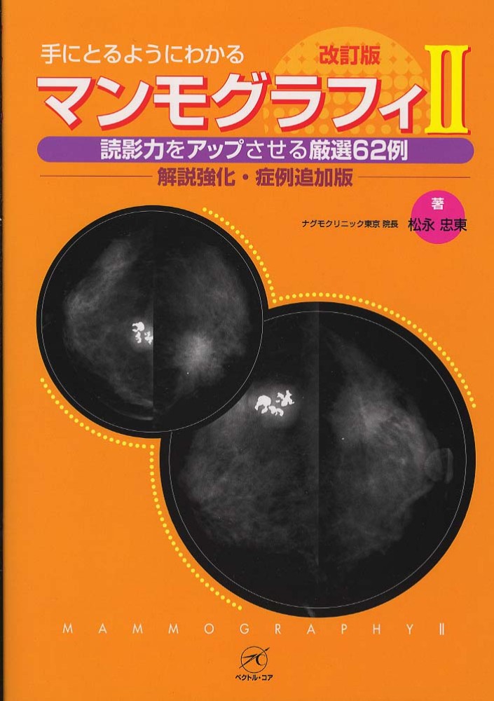 (手にとるようにわかる)-　マンモグラフィII　解説強化・症例追加版　改訂版　読影力をアップさせる厳選62例