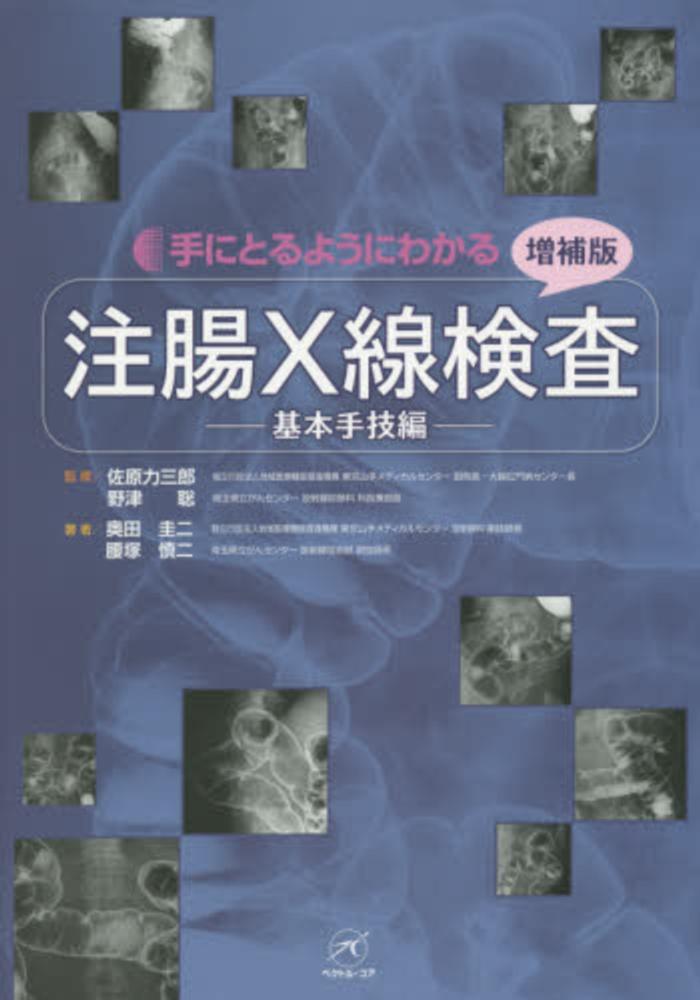 注腸X線検査〜基本手技編〜【増補版】 (手にとるようにわかる