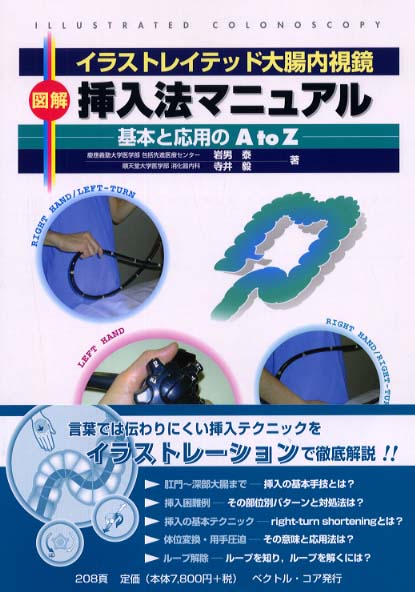 イラストレイテッド大腸内視鏡ー図解 挿入法マニュアル?基本と応用のA to Z? [単行本] 岩男 泰; 寺井 毅 イラストレイテッド大腸内視鏡図解挿入法マニュアル / 岩男 泰